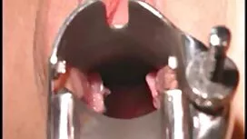 أنا سخيف هذا الرزمة  ...