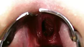 صديقتي بين الشراشف س ...